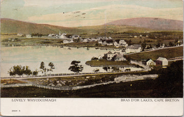 Bras D'OR Lakes Cape Breton NS Nova Scotia Lovely Whycocomagh Postcard 